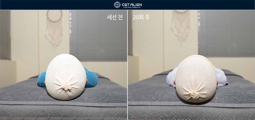 전후사진