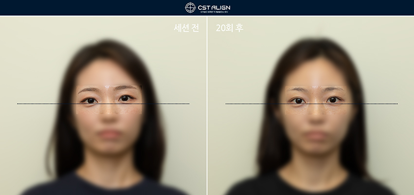 전후사진